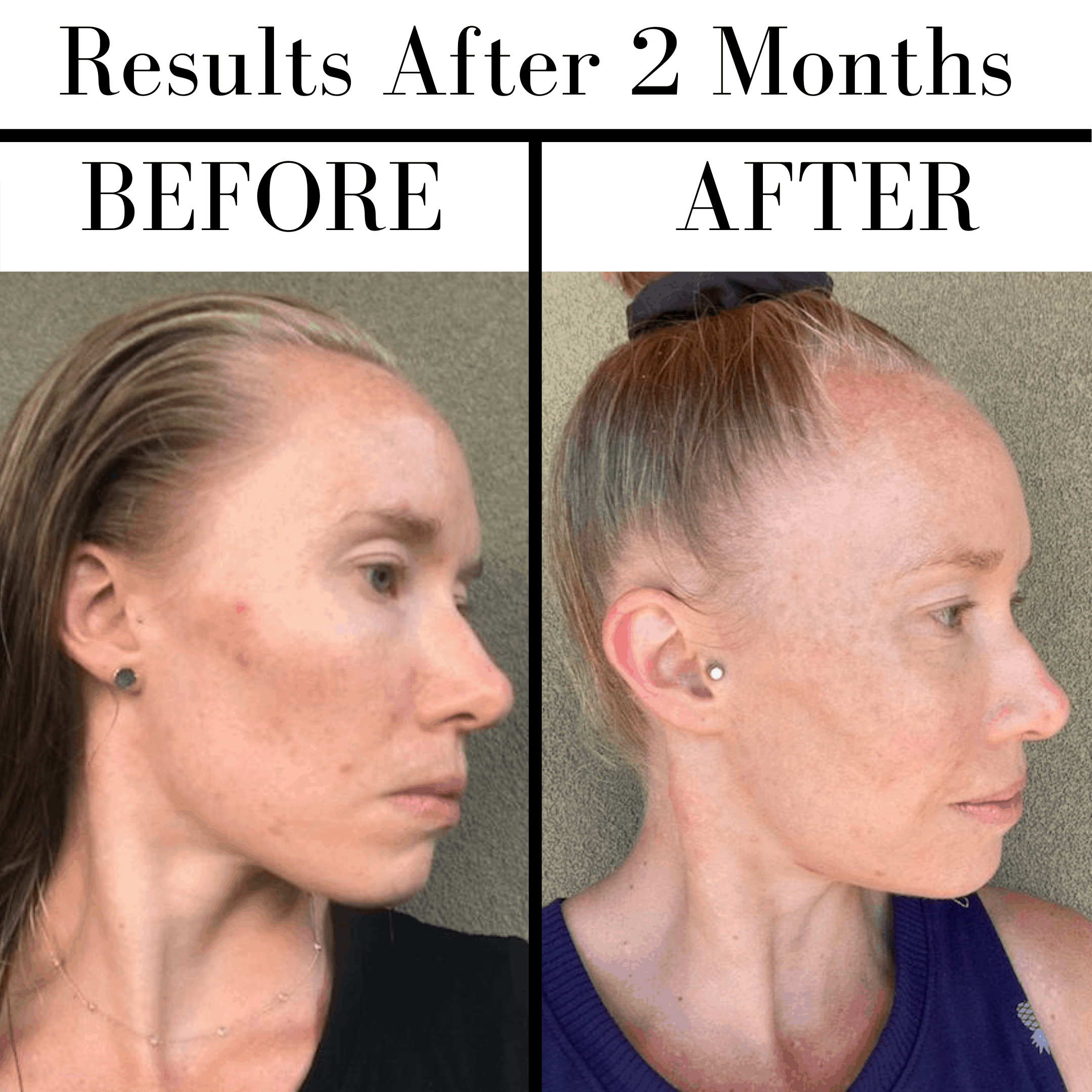 Before and after photos from using the Beautycounter Vitamin C Serum.