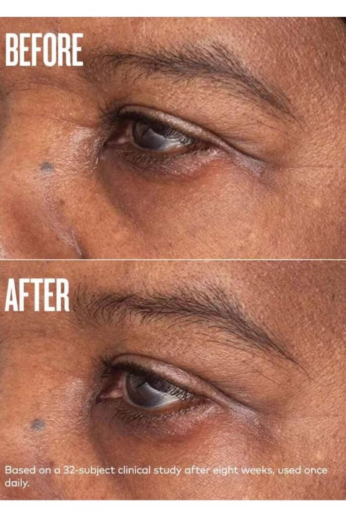 Before and after photos of an eye where a plumping cream has been applied.