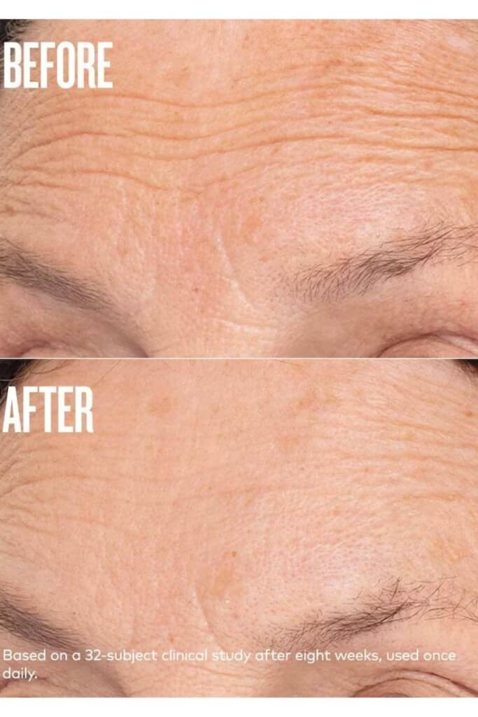 Before and after photos of a forehead that has used a plumping cream.