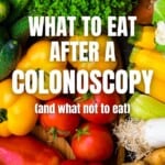 Different fruits and vegetables including peppers, lettuce and ginger with the words What To Eat After A Colonoscopy over them.